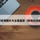 防控疫情图片大全集最新（防疫控疫图片）